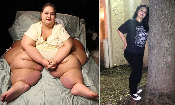 فيديو وصور لم تر مثلها من قبل! أثقل امرأة بالعالم تخسر 360 كيلو من وزنها! صورة رقم 5 فيديو وصور لم تر مثلها من قبل! أثقل امرأة بالعالم تخسر 360 كيلو من وزنها! صورة رقم 5