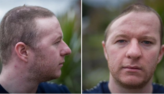 لكمة واحدة تُفقده نصف جمجمته ! صورة رقم 1 لكمة واحدة تُفقده نصف جمجمته ! صورة رقم 1