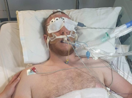 لكمة واحدة تُفقده نصف جمجمته ! صورة رقم 3 لكمة واحدة تُفقده نصف جمجمته ! صورة رقم 3