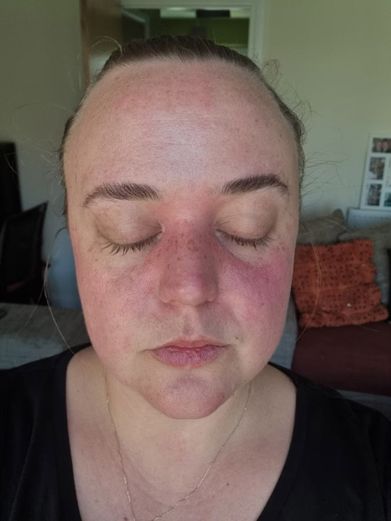 حالة نادرة تتسبب في غلق عينيها أثناء القيادة صورة رقم 3