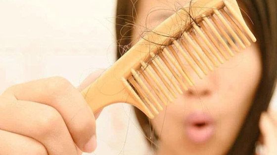 لعلاج تساقط الشعر.. إليك 7 طرق طبيعية فعالة صورة رقم 2