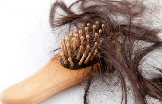 لعلاج تساقط الشعر.. إليك 7 طرق طبيعية فعالة صورة رقم 8