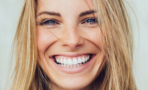 إليكم 5 طرق مدهشة لابتسامة هوليوودية دون تبييض الأسنان صورة رقم 3