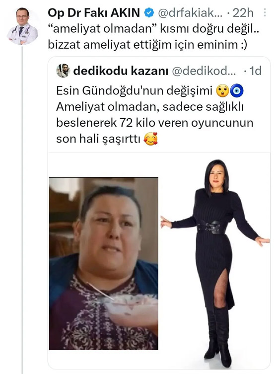 صور: نجمة تركية محرجة بعد أن كذبها طبيبها وفضحها! ادعت خسارة وزنها طبيعيا صورة رقم 2 صور: نجمة تركية محرجة بعد أن كذبها طبيبها وفضحها! ادعت خسارة وزنها طبيعيا صورة رقم 2