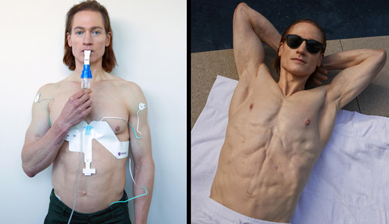 ملياردير أمريكي يتبادل بلازما الدم مع ابنه وأبيه السبعيني ليبدو بعمر 18 عاما! صورة رقم 14