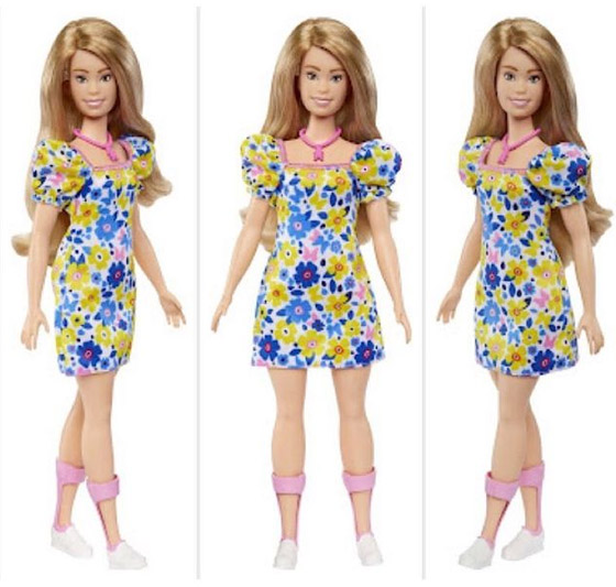 باربي جديدة بمتلازمة داون.. أول خطوة أمريكية لدمج ذوي الهمم صورة رقم 13