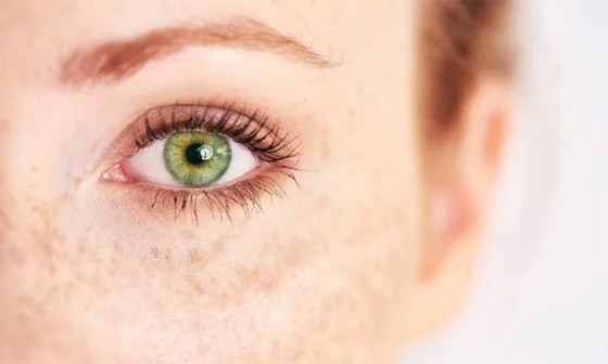 تعرف إلى 6 من أندر ألوان العيون وأكثرها غرابة في العالم! صورة رقم 5