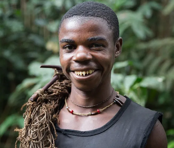 جماجم طويلة وشحذ الأسنان.. إليكم أغرب 6 معايير جمال عبر التاريخ صورة رقم 3