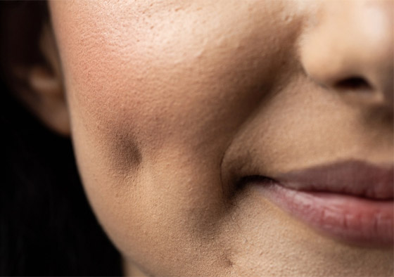 جماجم طويلة وشحذ الأسنان.. إليكم أغرب 6 معايير جمال عبر التاريخ صورة رقم 6