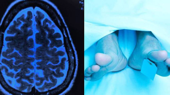 وعي قبل الوفاة.. دراسة تكشف تفاصيل اللحظات الأخيرة قبل الموت صورة رقم 2