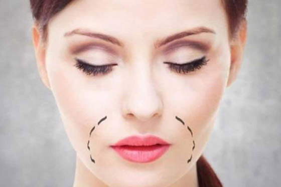 التصبغ حول الفم.. أسبابه وعلاجه صورة رقم 5