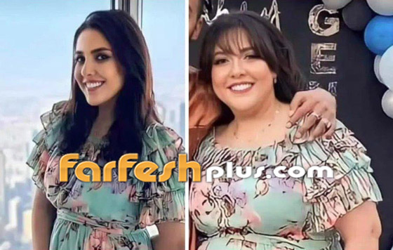 صور مي كساب قبل وبعد تكميم المعدة.. لن تصدق الفرق! خسرت وزنا هائلا وملامحها تغيرت! صورة رقم 4 صور مي كساب قبل وبعد تكميم المعدة.. لن تصدق الفرق! خسرت وزنا هائلا وملامحها تغيرت! صورة رقم 4