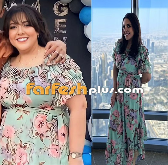 صور مي كساب قبل وبعد تكميم المعدة.. لن تصدق الفرق! خسرت وزنا هائلا وملامحها تغيرت! صورة رقم 1 صور مي كساب قبل وبعد تكميم المعدة.. لن تصدق الفرق! خسرت وزنا هائلا وملامحها تغيرت! صورة رقم 1