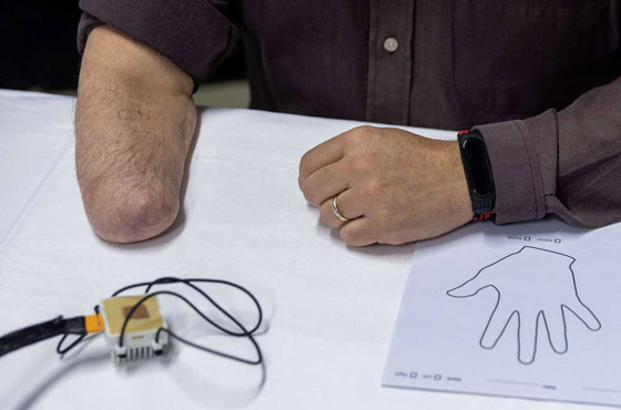 الشعور باللمس.. تقنية علمية تمنح أملا لمبتوري اليد.. فيديو صورة رقم 1 الشعور باللمس.. تقنية علمية تمنح أملا لمبتوري اليد.. فيديو صورة رقم 1