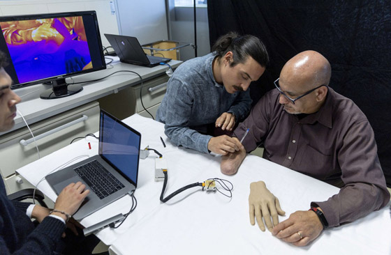 الشعور باللمس.. تقنية علمية تمنح أملا لمبتوري اليد.. فيديو صورة رقم 4 الشعور باللمس.. تقنية علمية تمنح أملا لمبتوري اليد.. فيديو صورة رقم 4