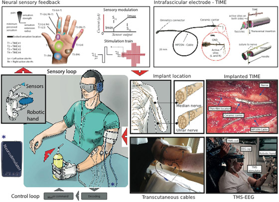 الشعور باللمس.. تقنية علمية تمنح أملا لمبتوري اليد.. فيديو صورة رقم 2 الشعور باللمس.. تقنية علمية تمنح أملا لمبتوري اليد.. فيديو صورة رقم 2