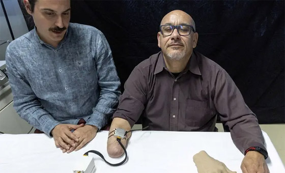 الشعور باللمس.. تقنية علمية تمنح أملا لمبتوري اليد.. فيديو صورة رقم 3 الشعور باللمس.. تقنية علمية تمنح أملا لمبتوري اليد.. فيديو صورة رقم 3