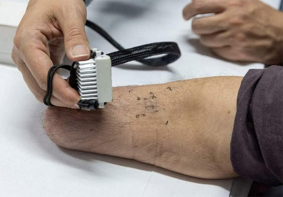 الشعور باللمس.. تقنية علمية تمنح أملا لمبتوري اليد.. فيديو صورة رقم 12 الشعور باللمس.. تقنية علمية تمنح أملا لمبتوري اليد.. فيديو صورة رقم 12