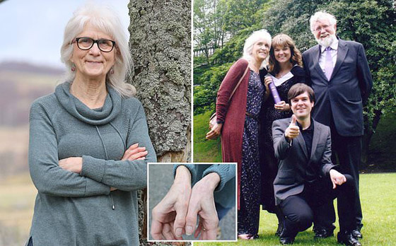 فيديو: ألهمت العلماء لتطوير مسكنات خارقة.. سيدة لا تعرف معنى الألم! صورة رقم 2