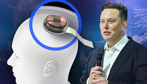 شركة إيلون ماسك ستزرع رقائق إلكترونية بالأدمغة! يبحثون عن متطوعين للتجارب صورة رقم 2 شركة إيلون ماسك ستزرع رقائق إلكترونية بالأدمغة! يبحثون عن متطوعين للتجارب صورة رقم 2