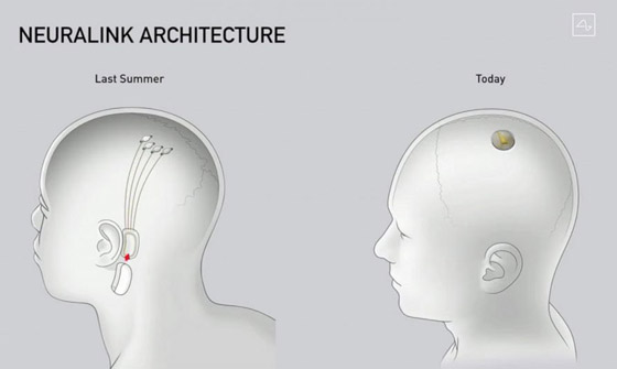 شركة إيلون ماسك ستزرع رقائق إلكترونية بالأدمغة! يبحثون عن متطوعين للتجارب صورة رقم 12 شركة إيلون ماسك ستزرع رقائق إلكترونية بالأدمغة! يبحثون عن متطوعين للتجارب صورة رقم 12