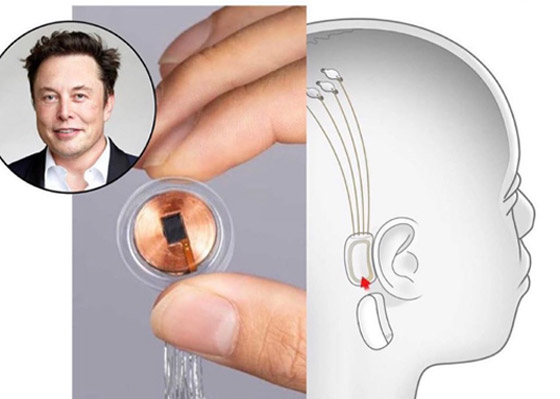 شركة إيلون ماسك ستزرع رقائق إلكترونية بالأدمغة! يبحثون عن متطوعين للتجارب صورة رقم 14 شركة إيلون ماسك ستزرع رقائق إلكترونية بالأدمغة! يبحثون عن متطوعين للتجارب صورة رقم 14