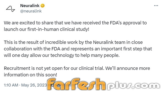 شريحة ماسك للأدمغة.. موافقة رسمية لبدء التجارب على البشر صورة رقم 1