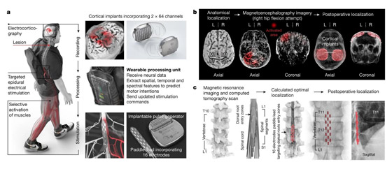 فيديو لمعجزة تكنولوجية.. رجل مصاب بالشلل يتمكن من المشي مجددا صورة رقم 15 فيديو لمعجزة تكنولوجية.. رجل مصاب بالشلل يتمكن من المشي مجددا صورة رقم 15