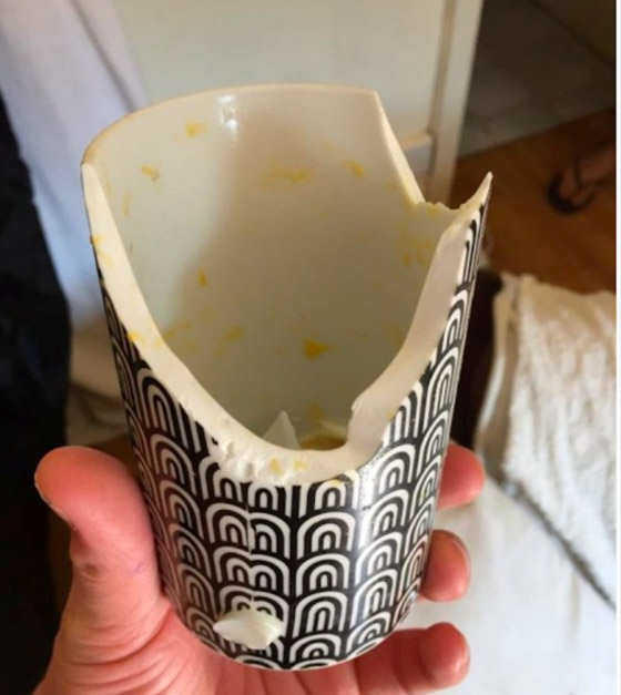 بيضة تشوه وجه امرأة بسبب حيلة على تيك توك صورة رقم 2