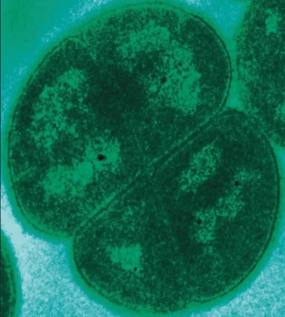 7 حيوانات يمكنها النجاة من آثار القنبلة النووية ! صورة رقم 8 7 حيوانات يمكنها النجاة من آثار القنبلة النووية ! صورة رقم 8