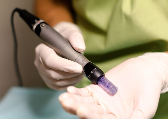 اختبار دم بسيط يساعد بمعرفة الإصابة بالسرطان ومن ثم سرعة التشخيص صورة رقم 4