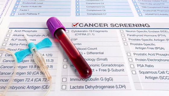 اختبار دم بسيط يساعد بمعرفة الإصابة بالسرطان ومن ثم سرعة التشخيص صورة رقم 3
