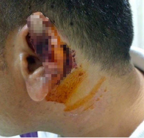 نورس يلتهم أذن رجل بعد شجار غريب في اسطنبول صورة رقم 1