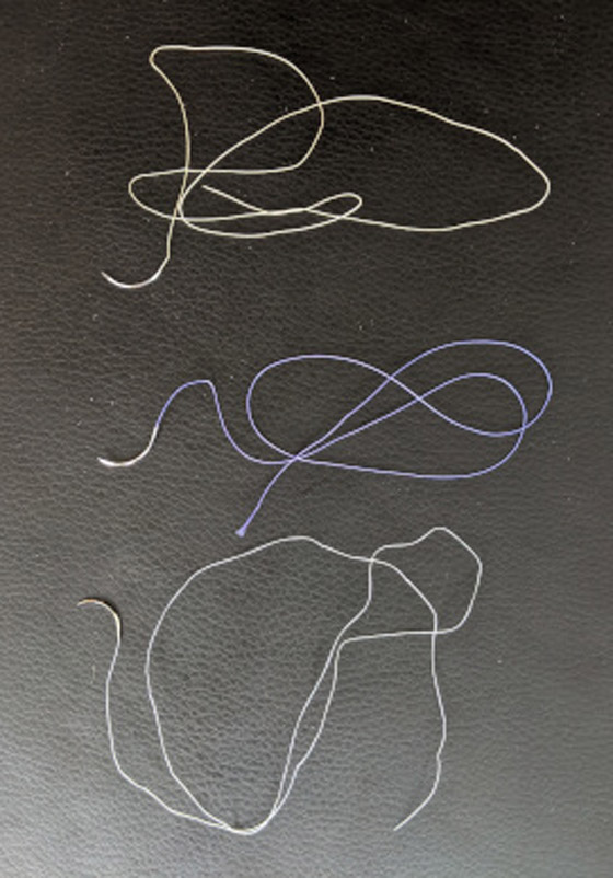 لتسريع الشفاء بعد الجراحة.. ابتكار خيوط قابلة للذوبان صورة رقم 8 لتسريع الشفاء بعد الجراحة.. ابتكار خيوط قابلة للذوبان صورة رقم 8