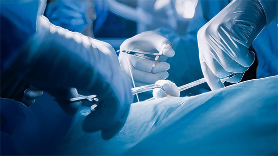 لتسريع الشفاء بعد الجراحة.. ابتكار خيوط قابلة للذوبان صورة رقم 2 لتسريع الشفاء بعد الجراحة.. ابتكار خيوط قابلة للذوبان صورة رقم 2