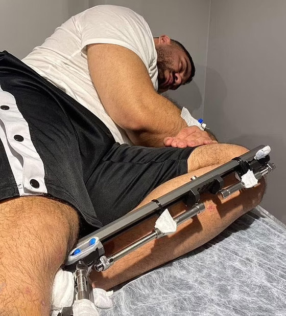  ���� ��� 11 - ��� ���� �� �����.. ��� ������ ���� ����� ����� ���� 17 ��