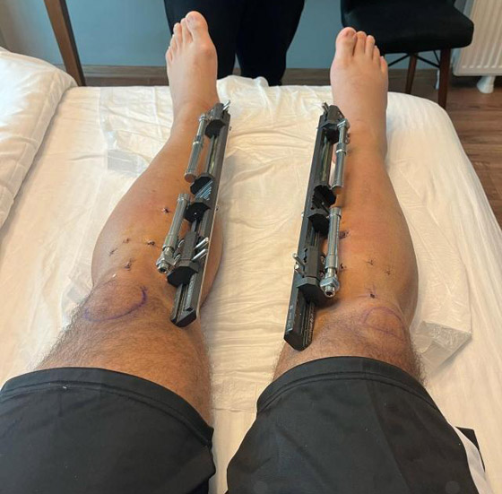  ���� ��� 5 - ��� ���� �� �����.. ��� ������ ���� ����� ����� ���� 17 ��