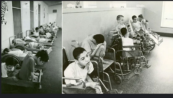 10 تجارب طبية وحشية احتلت مكانتها في التاريخ! صورة رقم 9