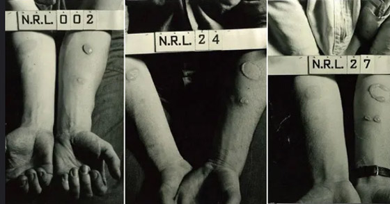 10 تجارب طبية وحشية احتلت مكانتها في التاريخ! صورة رقم 3