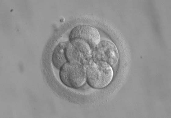 اختراق علمي مذهل وخوف على البشر: أجنة بشرية اصطناعية تثير الجدل! صورة رقم 4