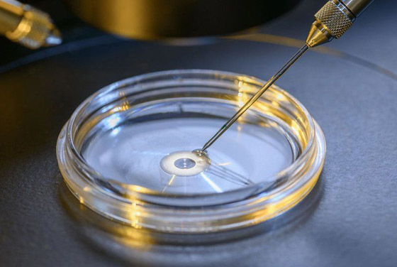 اختراق علمي مذهل وخوف على البشر: أجنة بشرية اصطناعية تثير الجدل! صورة رقم 7