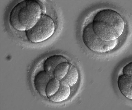 اختراق علمي مذهل وخوف على البشر: أجنة بشرية اصطناعية تثير الجدل! صورة رقم 10