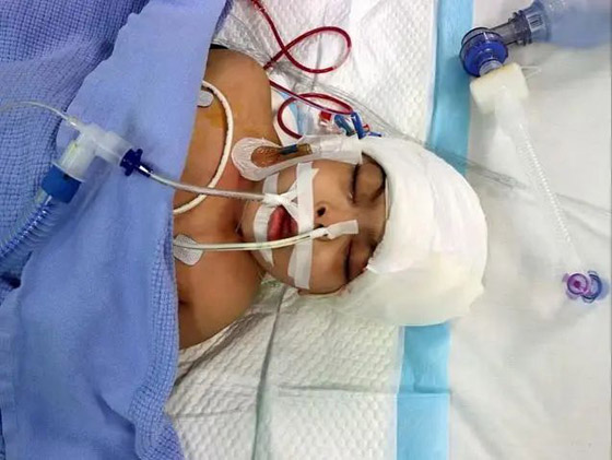 نجاح فصل السيامي المصري سلمى وسارة بالسعودية بعد 17 ساعة.. صورة رقم 3 نجاح فصل السيامي المصري سلمى وسارة بالسعودية بعد 17 ساعة.. صورة رقم 3