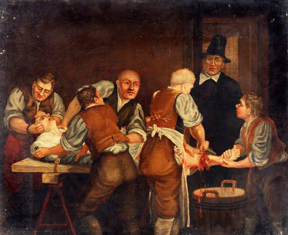 5 طرق غريبة ومفزعة في علاج الصداع قديمًا صورة رقم 1