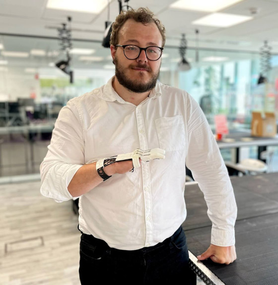 صور: طالب بريطاني يخترع لنفسه يدا اصطناعية باستخدام طابعة ثلاثية الأبعاد صورة رقم 1