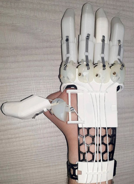 صور: طالب بريطاني يخترع لنفسه يدا اصطناعية باستخدام طابعة ثلاثية الأبعاد صورة رقم 2