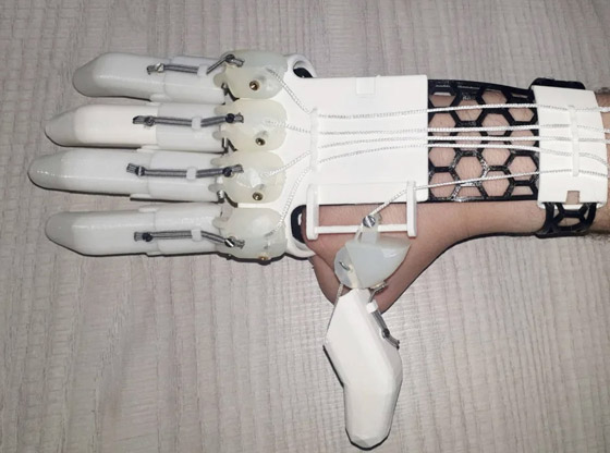 صور: طالب بريطاني يخترع لنفسه يدا اصطناعية باستخدام طابعة ثلاثية الأبعاد صورة رقم 4