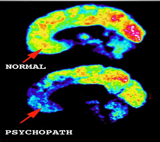 العلم: هل من الممكن أن تنتقل 