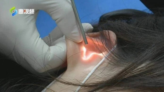  قبلة تصيب امرأة بتمزق في طبلة الأذن! صورة رقم 1