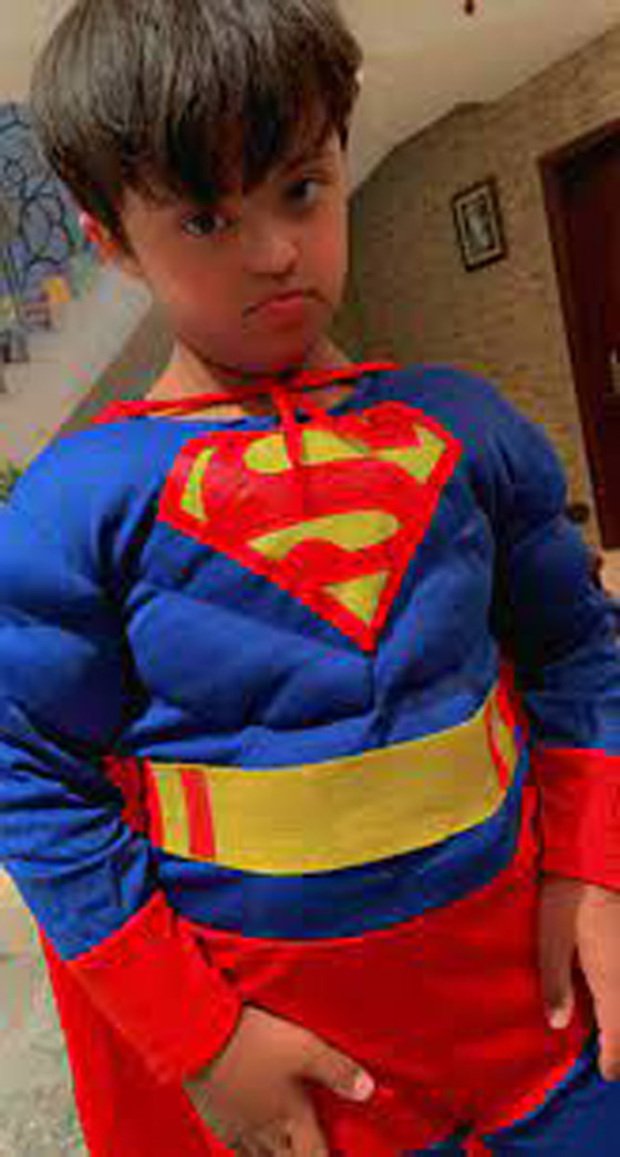 متلازمة سوبر مان حقيقة وليست خيال! ما هي؟ وكيف تحدث؟ صورة رقم 7